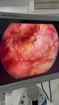 Dr Younès El Belkasmi